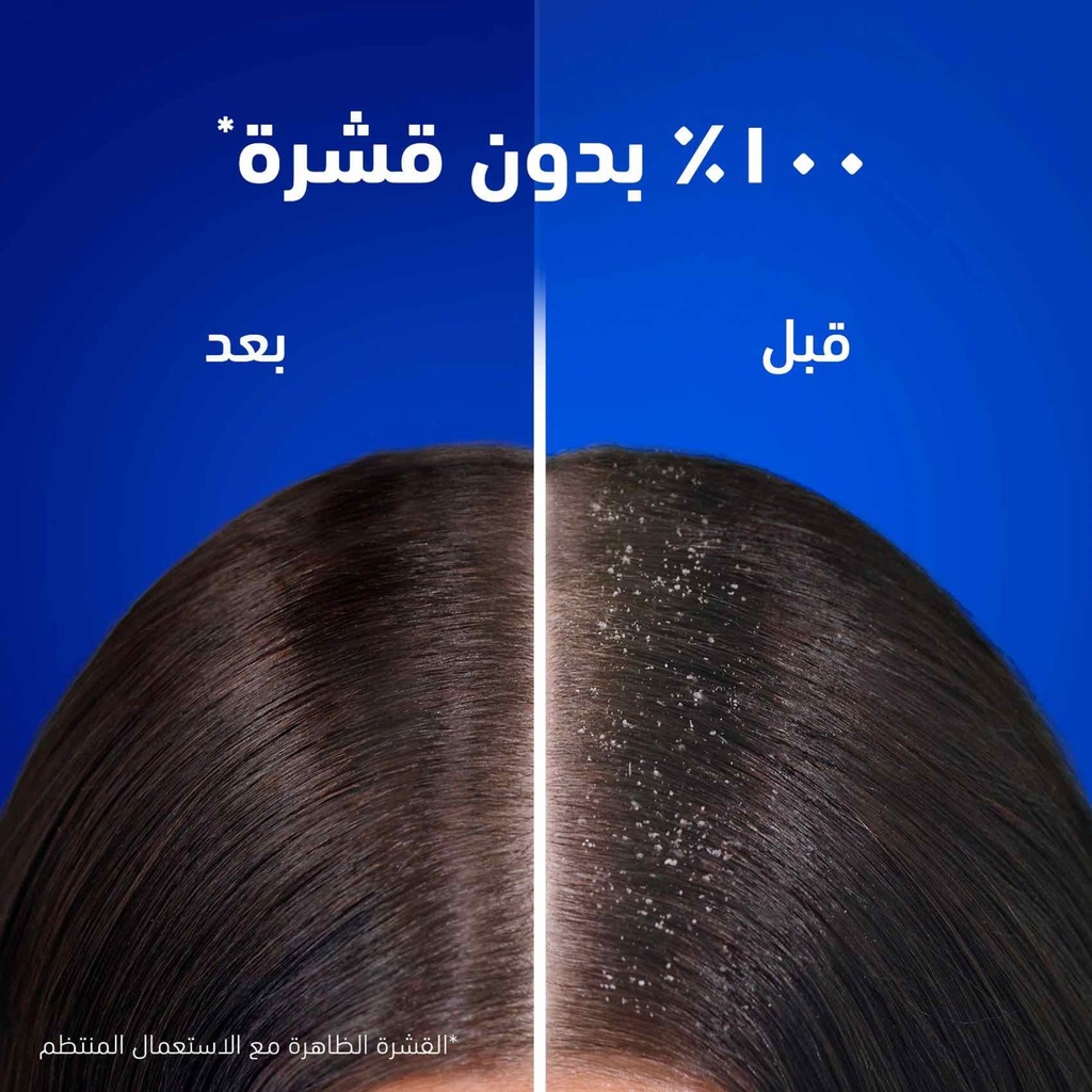هيد اند شولدرز شامبو 600 مل -انتعاش التفاح - صورة 2